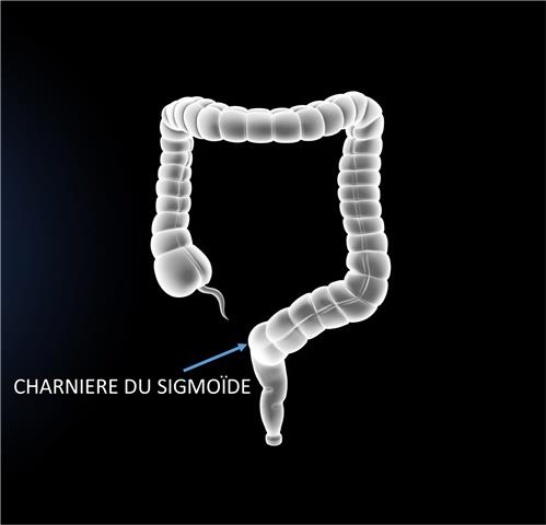 Cliquer pour agrandir